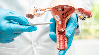 HIFU – alternativă la embolizarea fibromului uterin